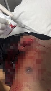 Empat Brimob Terluka dalam Insiden Berdarah di Manggarai Barat, Pelaku Masih Diburu