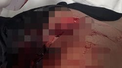Empat Brimob Terluka dalam Insiden Berdarah di Manggarai Barat, Pelaku Masih Diburu