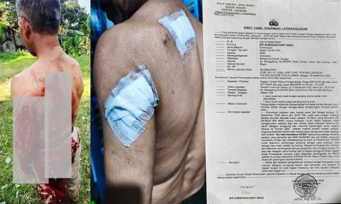 Penganiayaan Berat di Caringin Bogor: Wilson Lalengke Kecam Aksi Main Hakim Sendiri, Desak Polisi Usut Tuntas Terduga Pelaku ‘Imron’